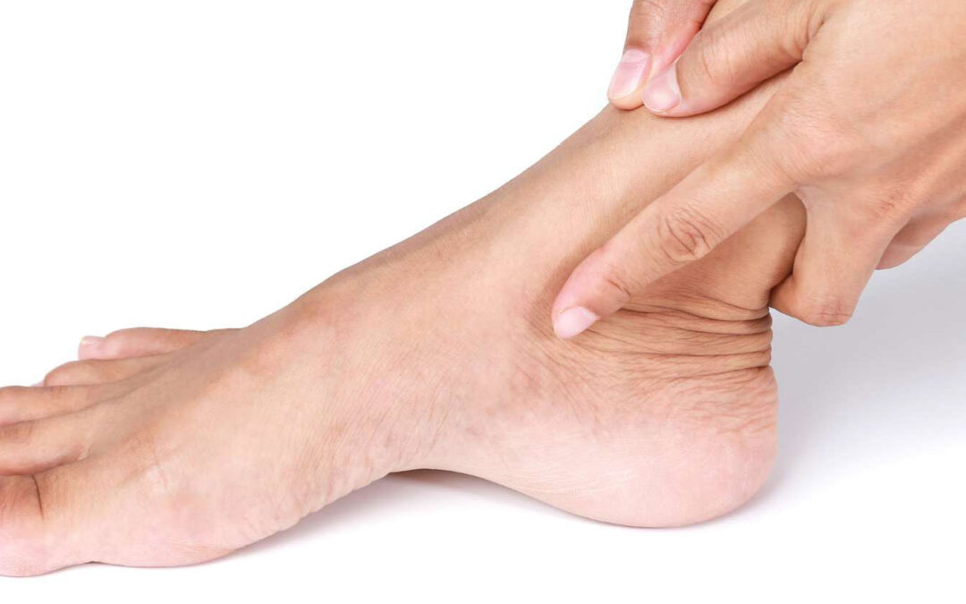 Ankle Ligament Reconstruction: What You Need to Know